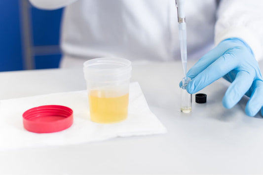 Een arts test een urinemonster